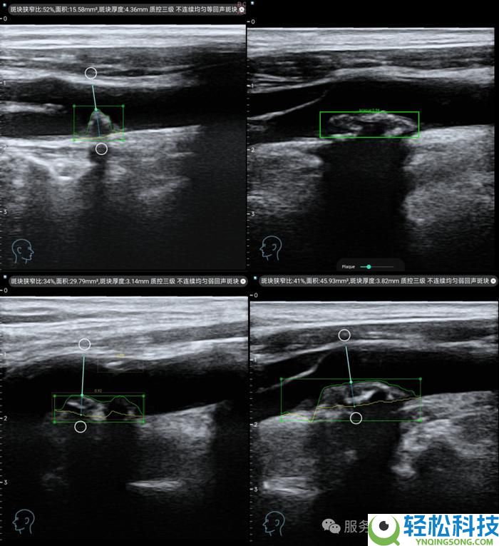 科技推进;回森智能客服焕新,以AI处理计划推进