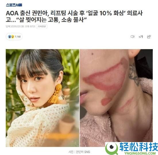 烧的太惨烈,韩国女星做医美居然致使面度灼伤