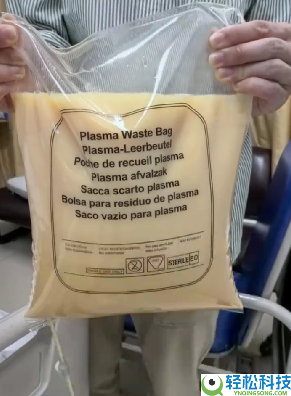 男人会餐后体内滤出7斤油 当场吓懵：这么一大袋