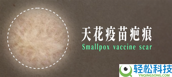 小时辰打过的疫苗：背地是一场逾越几代人的公共卫生战争