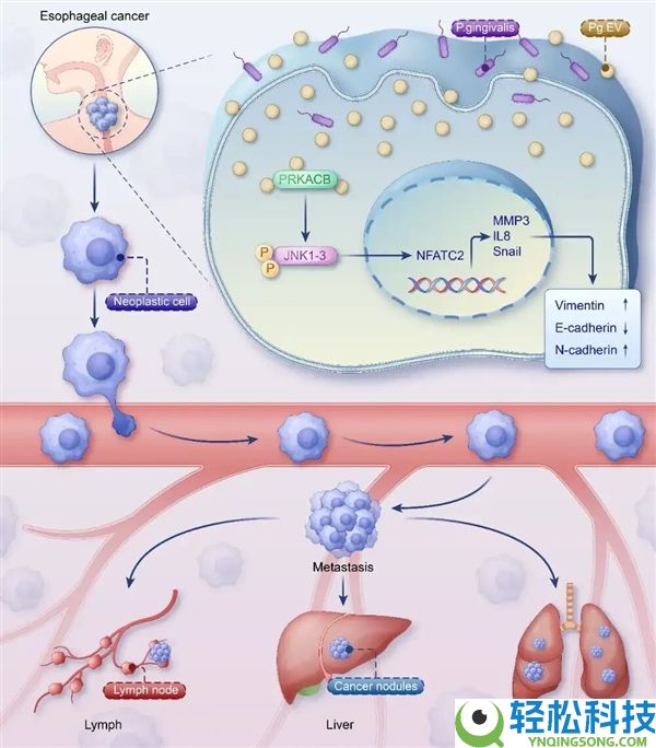 牙没刷好 居然会助推癌细胞转移?
