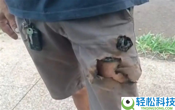巴西男人被两条狗狂咬 手机倏忽爆炸救了他一命
