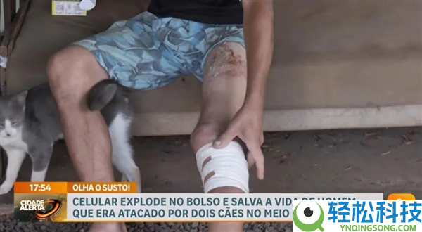 巴西男人被两条狗狂咬 手机倏忽爆炸救了他一命
