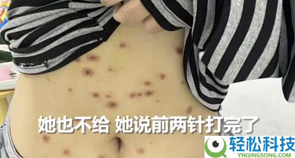 女生800元买猫被传染全身长猫藓 医治破费已近千元