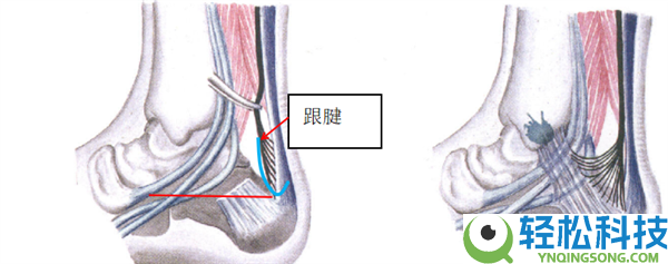 为什么有的人脚脖子粗 有的人脚脖子细?
