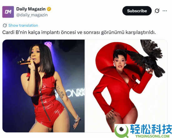 Cardi B整形前后对照暴光 曾花800美元暗盘打针