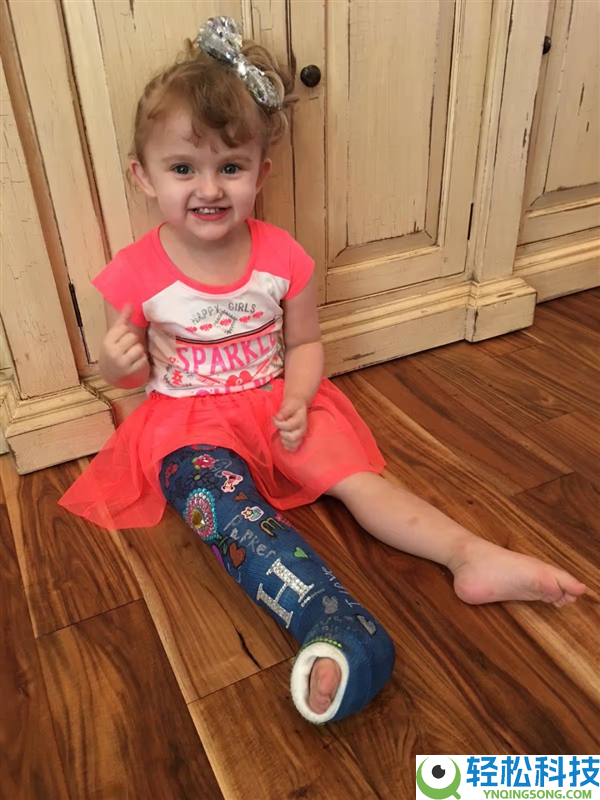 1个月女婴多处骨折 父母险被抓 一查竟是稀有病