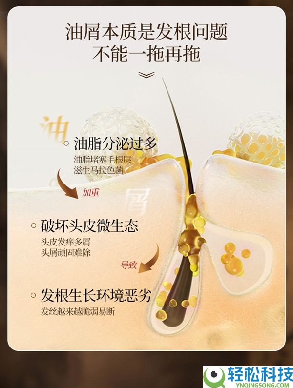 去屑止痒 强韧发丝,霸王生姜洗发水发车：领43元优惠券