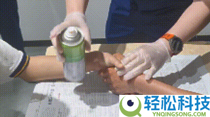 两男生被502胶水粘手2小时 大夫也束手无策 119出马